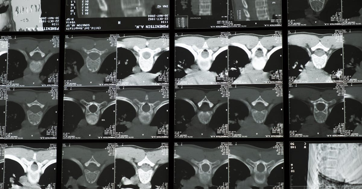 découvrez l'imagerie par résonance magnétique (irm), une technique médicale avancée permettant d'obtenir des images détaillées du corps humain. apprenez-en plus sur son fonctionnement, ses applications et son importance dans le diagnostic médical.