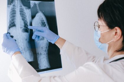 découvrez tout ce qu'il faut savoir sur l'irm (imagerie par résonance magnétique), une technique d'imagerie non invasive révolutionnaire utilisée pour diagnostiquer avec précision de nombreuses conditions médicales. explorez ses avantages, son fonctionnement et son importance dans le domaine de la santé.